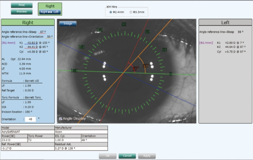 NIDEK Optický Biometer AL-Scan