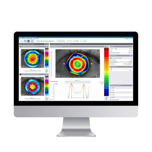 Oculus Pentacam Software
